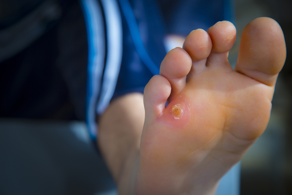 Wound Care Middletown NJ
